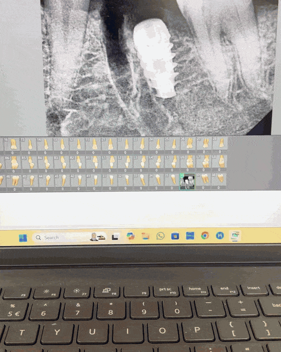Dental consultation at Supreme Elite Clinic Kelambakkam